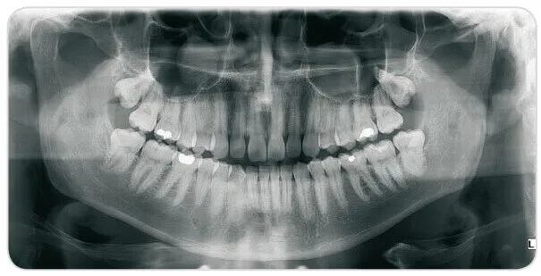 Advanced digital dental radiology equipment at Denticare India