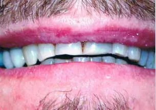 Before smile design treatment patient case study
