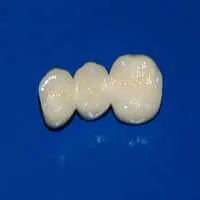 Zirconia Crowns - Denticare