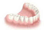 Successful multiple teeth implants clinical outcome